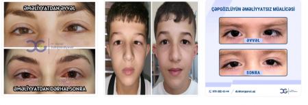 Göz Sağlamlığının Qoruyucusu: Dr. Günel Xalıqverdiyeva – Təcrübəli və Fədakar Oftalmoloq